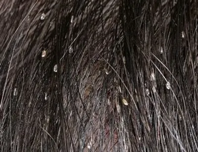 Illustration nit - Image 2