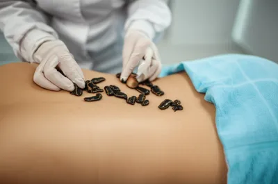 Illustration leeching - Image 1