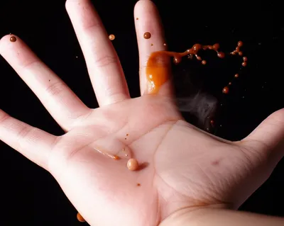 Illustration scald - Image 1