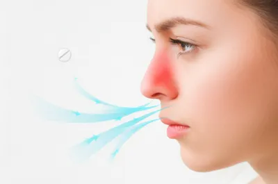 Illustration decongestant