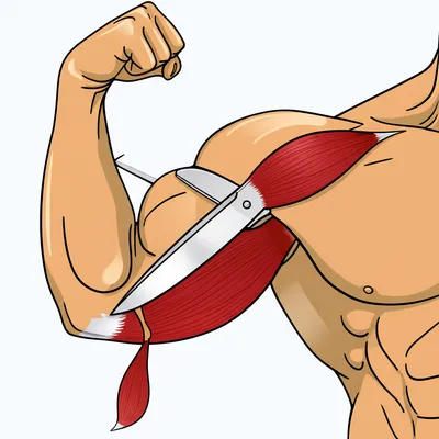 Illustration nerfed - Image 1