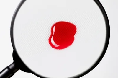 Illustration aggravating