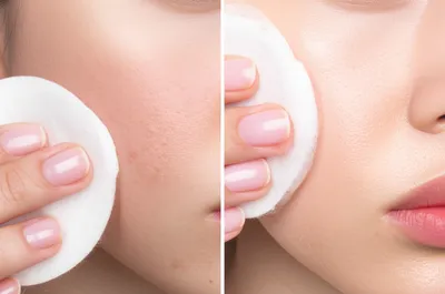 Illustration toners - Image 1