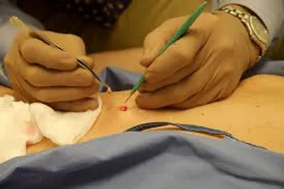 Illustration excision - Image 2