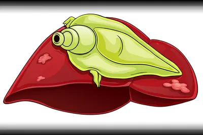 Illustration fluke - Image 1