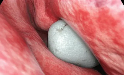 Illustration calculus - Image 1