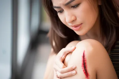 Illustration gash - Image 1