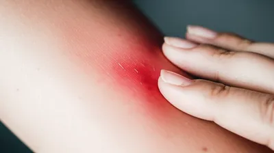 Illustration irritate - Image 1