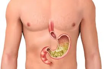Illustration gastric - Image 2