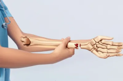 Illustration extension - Image 1