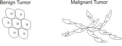 Illustration benign - Image 2