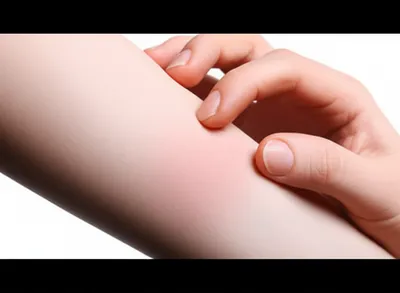 Illustration itch - Image 1