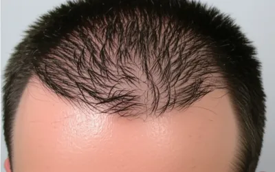 Illustration stubble - Image 1