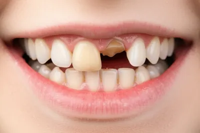 Illustration snags - Image 1