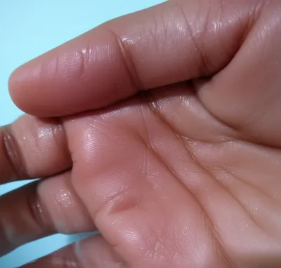 Illustration prune - Image 1