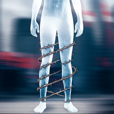 Illustration paralyze - Image 1