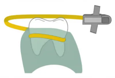 Illustration dam - Image 1