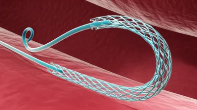 Illustration pigtail - Image 1