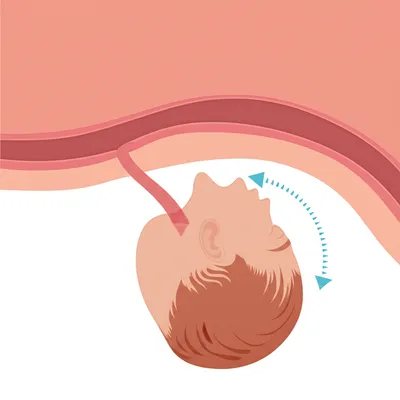 Illustration restitution - Image 1