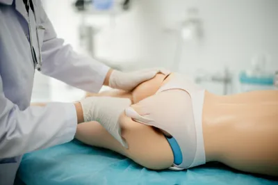 Illustration rectal - Image 1