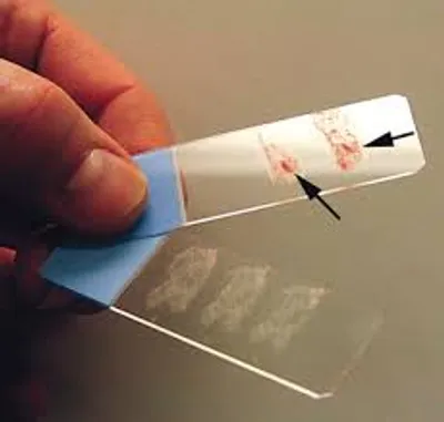 Illustration smear - Image 3