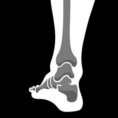 Illustration heel - Image 1