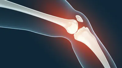 Illustration articular