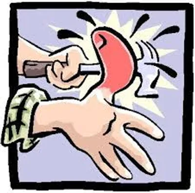 Illustration hurt - Image 2