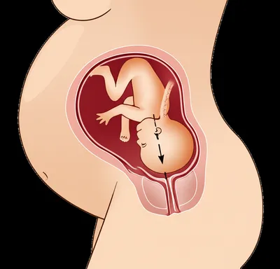 Illustration engaged - Image 1