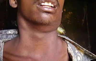 Illustration plague - Image 2