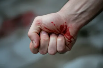 Illustration stemming - Image 1