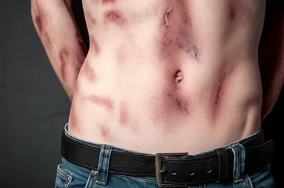 Illustration lacings - Image 1