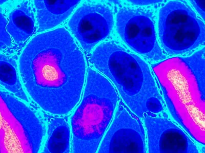 Illustration counterstain - Image 1