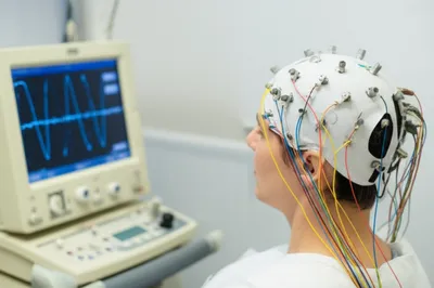 Illustration electroencephalograph