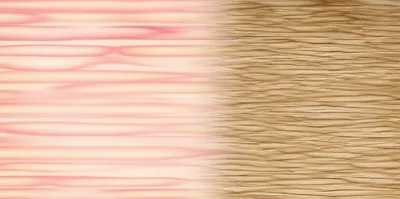 Illustration callus - Image 1