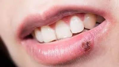 Illustration soreness - Image 2