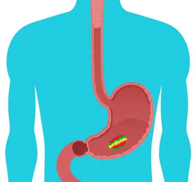 Illustration esophagus