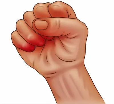 Illustration relaxation - Image 1