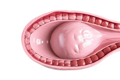 Illustration fannies