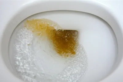 Illustration excretion - Image 1