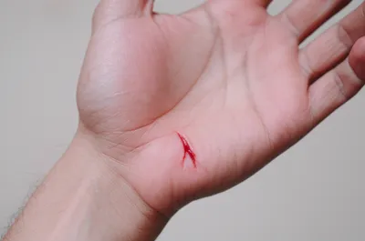 Illustration wounds - Image 1