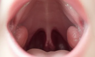 Illustration almond - Image 1