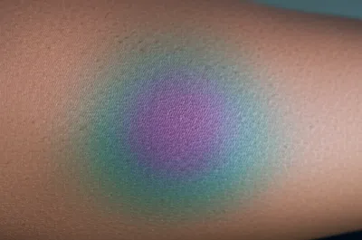 Illustration contusions