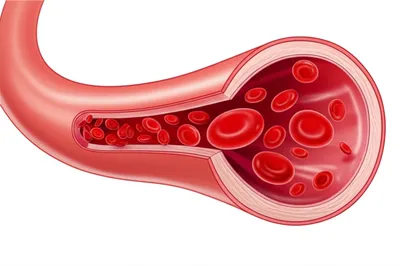 Illustration vasoconstriction