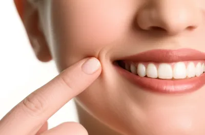 Illustration dimples - Image 1