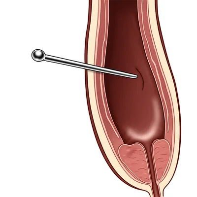 Illustration soundings - Image 1