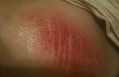 Illustration chafe - Image 2