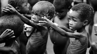 Illustration malnutrition - Image 2