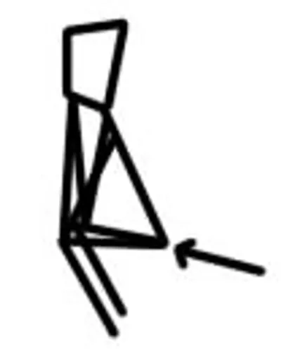 Illustration anus - Image 2