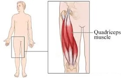 Illustration quad - Image 2